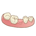 喪失歯